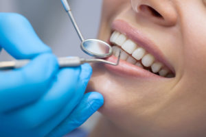 Patient undergoing Dental Implant Procedure Consultation