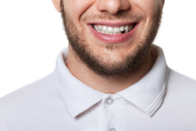 Dental Patient Missing A Tooth