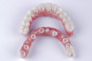 a model set of zirconia made full arch dental implants